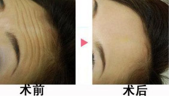 昆明那家整形醫(yī)院效果好？推薦吳氏嘉美、藝星、銅雀臺(tái)等