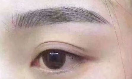 廣州整形美容醫(yī)院哪家效果好？近期網(wǎng)友推薦瘦身醫(yī)院名單一覽