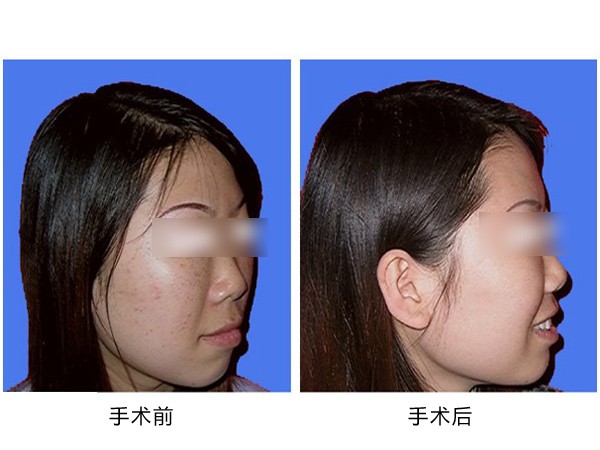 太原酒糟鼻激光整形美容醫(yī)院推薦！2023年十佳信譽美容機構(gòu)揭曉！