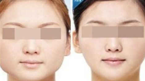 揭秘重慶美侖美奐整形美容醫(yī)院：預約攻略和收費實錄