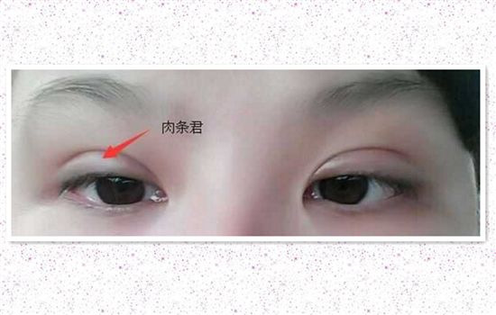山東哪家醫(yī)院能夠有效治療疤痕？當(dāng)?shù)鼐用窳λ]靠譜的正規(guī)醫(yī)療機(jī)構(gòu)