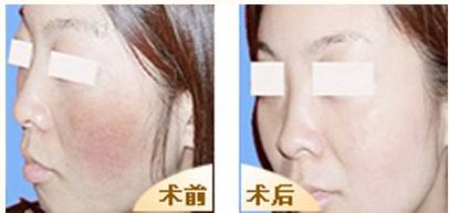 武漢市有哪些知名整形顴骨顴弓醫(yī)院？2023年排名前10美容醫(yī)院令人心動！