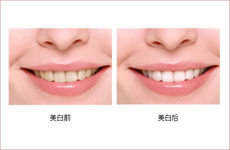 廣州最受贊譽(yù)的玻尿酸頸部皺紋填充醫(yī)院名單-2023全新推薦！