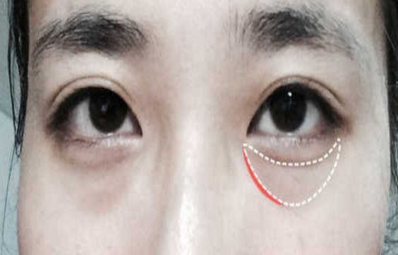 北京哪家醫(yī)院毛發(fā)種植效果好？