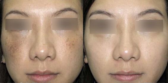 重慶哪個(gè)醫(yī)院割眼袋好？重慶佰視佳整形醫(yī)院地址聯(lián)系方式分析