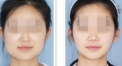 成都專業(yè)激光祛皺眼醫(yī)院排名榜單公布，綜合口碑實力前10大！