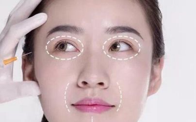 遼陽哪家醫(yī)院能有效改善眼睛細紋？排名前十大整形醫(yī)院解析！