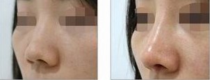 寧波哪家整形美容醫(yī)院能為您做出完美去眼袋效果？2023年最新排名出爐，top10強(qiáng)醫(yī)院揭曉！
