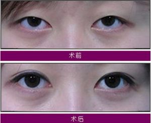 廣州手指畸形修復(fù)醫(yī)院排名10佳