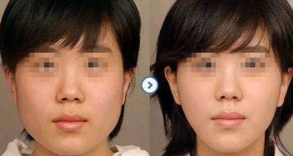 首爾麗格醫(yī)美：擁有年輕肌膚的秘密盡在這里！上海微整形醫(yī)美測評！