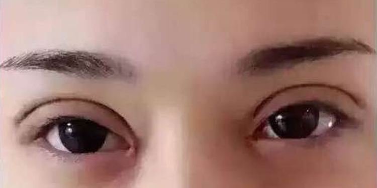 北京哪家醫(yī)院技術(shù)比較好？2023年抬頭紋治療美容醫(yī)院排行榜公布！
