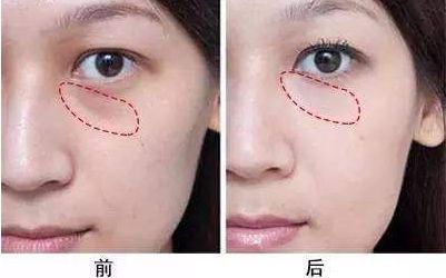 重塑容顏，迎接煥然一新！探尋成都最佳面部提升整形醫(yī)院，華西、華美、藝星等解析！