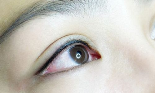 深圳朱燦隆鼻效果好嗎？醫(yī)生資歷、風(fēng)格，口碑和價(jià)格怎么樣？