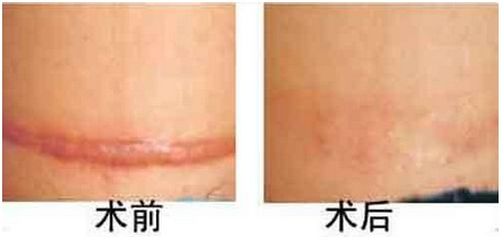 2023鄭州整形拉皮手術(shù)有經(jīng)驗的醫(yī)院推薦