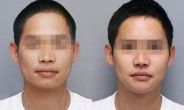徐州眼科三甲醫(yī)院有哪些？徐州第三院總面積6.37萬(wàn)平米，醫(yī)生超700人