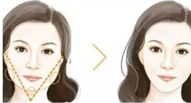 泉州眼科醫(yī)生推薦：瞳孔缺陷修復(fù)效果顯著！