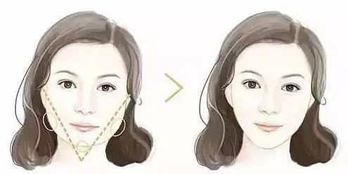 云南哪家醫(yī)院做雙眼皮好？
