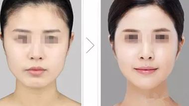 重慶除皺醫(yī)院排名揭曉，前五強(qiáng)醫(yī)院大比拼！