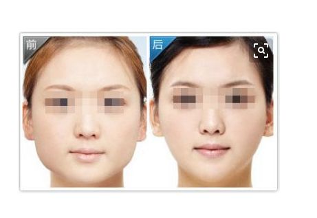 2024南昌植發(fā)費(fèi)用明細(xì)：權(quán)威醫(yī)院排名及收費(fèi)指南