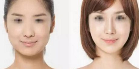 上海華美修復(fù)眼睛求助：楊亞益VS佀同帥，實(shí)力風(fēng)格大比拼！