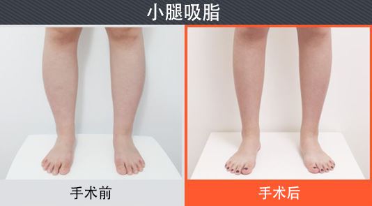 2023年上海十大墊下巴整形醫(yī)院推薦榜單，效果驚艷且備受口碑推崇！