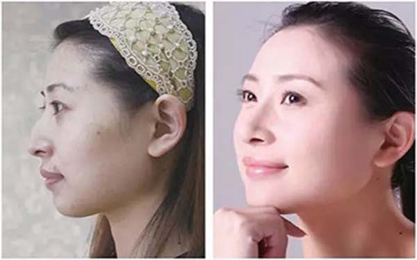 2023年性?xún)r(jià)比高的襄陽(yáng)自體脂肪移植整形醫(yī)院排行榜名單公布