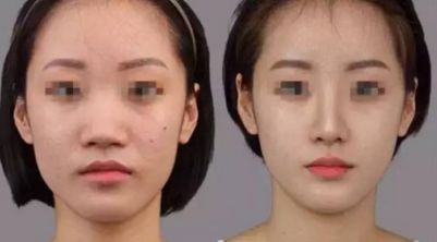 韓國(guó)皮膚管理醫(yī)院TOP10推薦：祛斑、祛痘必去之地