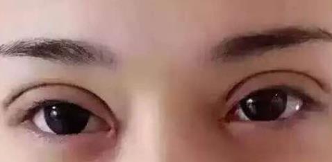 2023年西安矯正駝峰鼻整形醫(yī)院推薦，看看哪家性價比高！