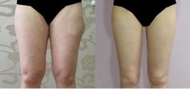 上海丨這幾家權(quán)威醫(yī)院打造脂肪填充技術(shù)，震撼揭曉！