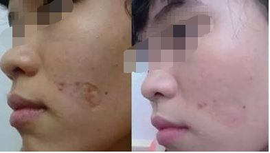 北京薇琳醫(yī)美，資深醫(yī)生團隊詳解，還有價格參考！