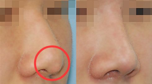 成都劉輔蓉眼睛修復(fù)效果如何？整形手冊(cè)一覽表為參考