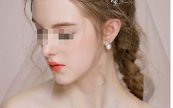汕頭華美整形熱門服務優(yōu)惠來襲：眼鼻隆胸美夢成真