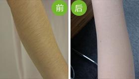 2023年重慶頰脂墊切除瘦臉醫(yī)院排名：整形效果杰出的前10家醫(yī)院大揭秘！