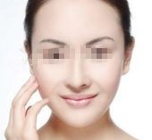 天津哪家醫(yī)院修復(fù)面部疤痕效果好？