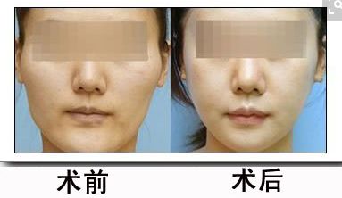 如何冷卻燙傷并有效預(yù)防難看疤痕