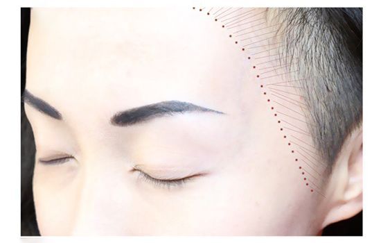 烏魯木齊伊麗莎白整形美容醫(yī)院口碑真的那么好嗎？整形效果靠譜嗎？