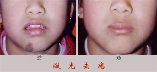 南京哪家整形醫(yī)院祛頸部皺紋做得好？2023年排名前10的美容醫(yī)院揭曉，令人驚嘆！