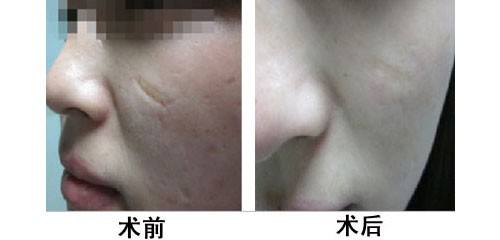 長春哪家熱瑪吉緊致肌膚醫(yī)院效果好？2023年正規(guī)整形醫(yī)院排名榜前十大揭曉！