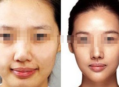 南通哪家皮膚美容醫(yī)院好？