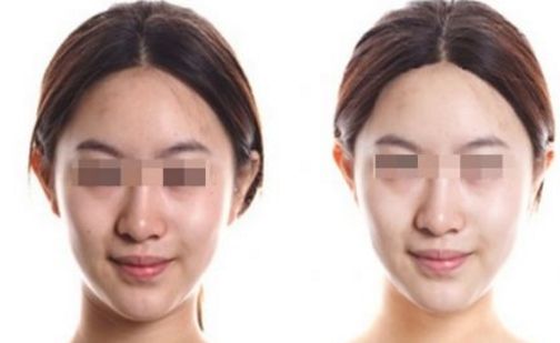 無(wú)錫市皮膚美容科專家推薦名單