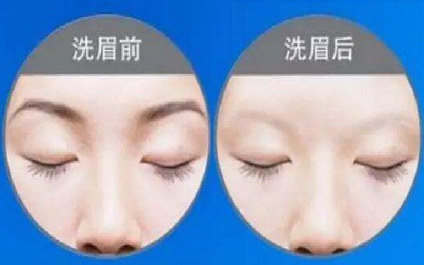鄭州隆鼻手術假體醫(yī)院排名榜單2023年新鮮出爐！醫(yī)院前十強大揭曉！