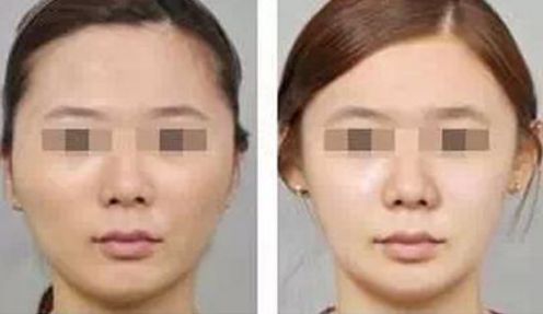 常德市市區(qū)口碑贊譽(yù)高的祛斑醫(yī)療中心推薦