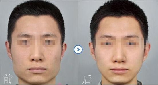 杭州生殖整形醫(yī)院前5家推薦 醫(yī)院評(píng)分及患者口碑