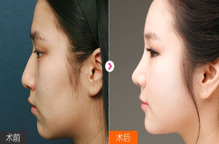 武漢綜合整形醫(yī)院排名前四：精準(zhǔn)對比同濟(jì)、省人民醫(yī)院！詳盡盤點(diǎn)！