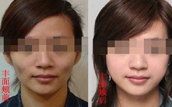 2023石家莊外眼角提升醫(yī)療美容醫(yī)院推薦排名前10強(qiáng)，口碑非好好！這些醫(yī)院不能錯(cuò)過！
