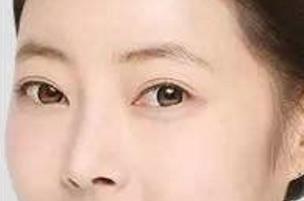 黑龍江哪些正規(guī)醫(yī)院是2023年治療打眼周紋的光電治療醫(yī)院選擇合輯