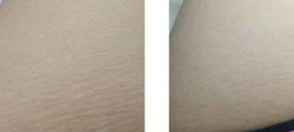 廈門熱瑪吉授權醫(yī)院排行榜：專利技術和聲譽雙重保障