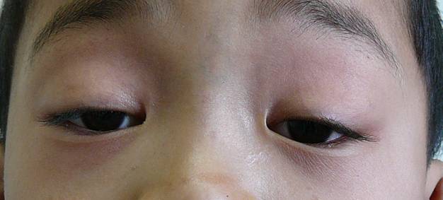 蘇州高口碑去副乳醫(yī)院，精準修復(fù)告別贅肉困擾！
