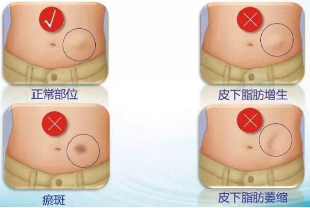 深圳弘美醫(yī)療美容門診部評(píng)價(jià)及價(jià)格查詢