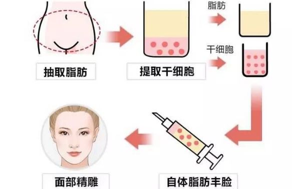青島鹿晰眼科：全激光近視手術(shù)價(jià)格及地址一覽，晶體植入費(fèi)用詳解